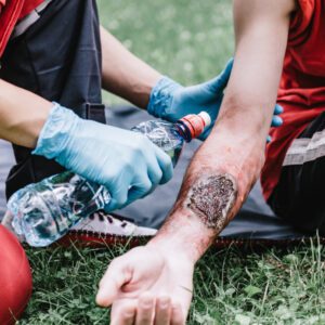 Paramedic pouring water from a bottle onto a severe burn on a person’s forearm